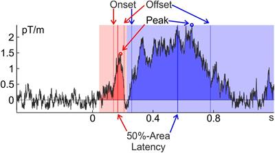 Estimating the Timing of Cognitive Operations With MEG/EEG Latency Measures: A Primer, a Brief Tutorial, and an Implementation of Various Methods